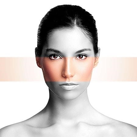 rhinoplasty surgery